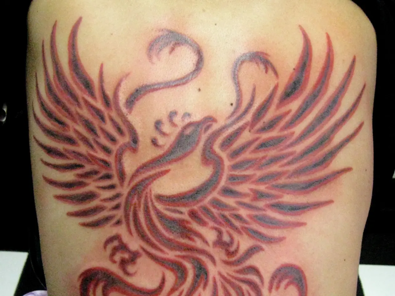 Penile Skin Tag: Identifying Causes, Diagnosis, and Removal Options