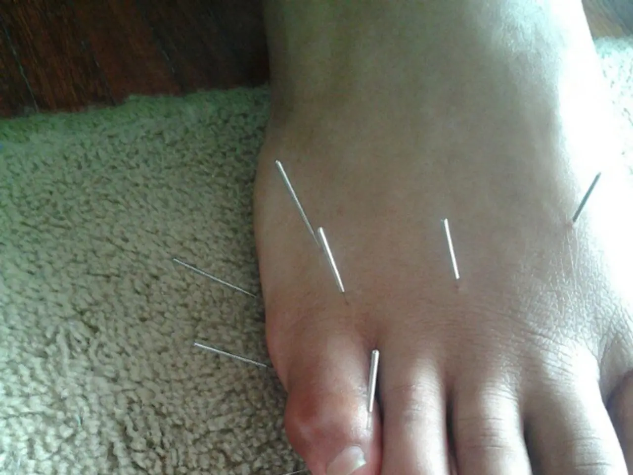 Misconceptions Surrounding Varicose Veins: Debunking 7 Common Misbeliefs