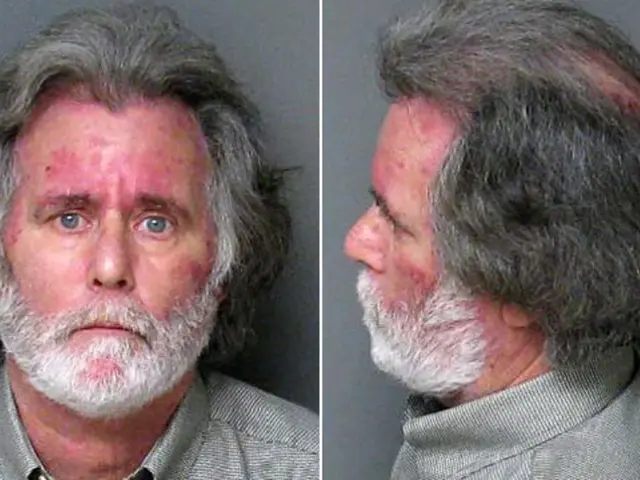 Singer Jessie J discloses successful breast cancer removal operation.