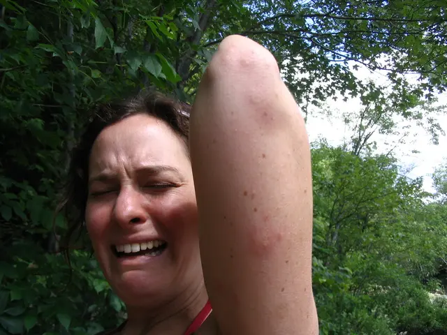 Recurring Depression Linked to changes in Seasons