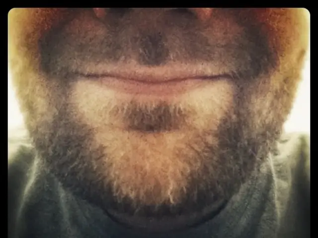 Blackhead Depth: Origins, Remedies, and Prevention Strategies