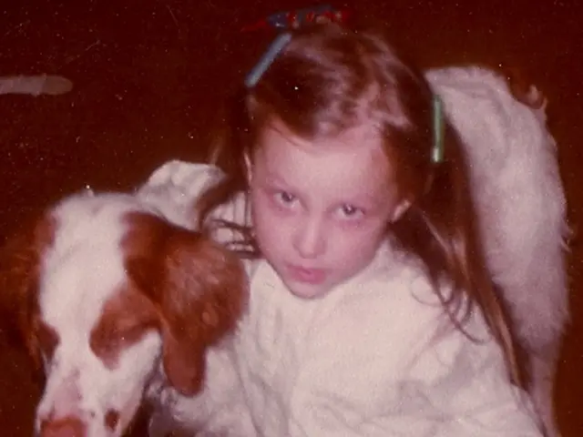 Arthritis that results in the formation of pus within a joint is known as Suppurative Arthritis.