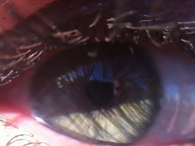 Comprehensive Information on Blepharoplasty Procedures in Delhi