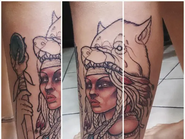 Scarred after breast reduction surgery? Here's a guide on managing expectations and minimizing...