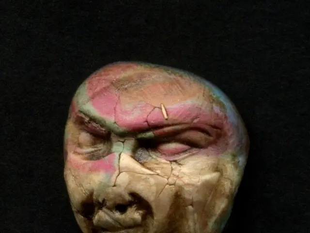 A pituitary tumor is a type of growth that occurs within the pituitary gland, which is located at...