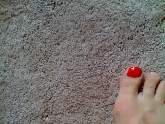 Understanding Peripheral Vascular Disease: An Overview