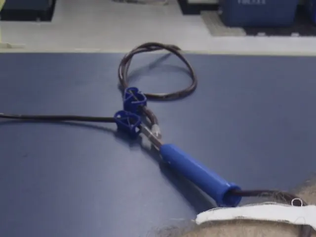 Clotting Issues: Understanding Thrombosis and Embolism